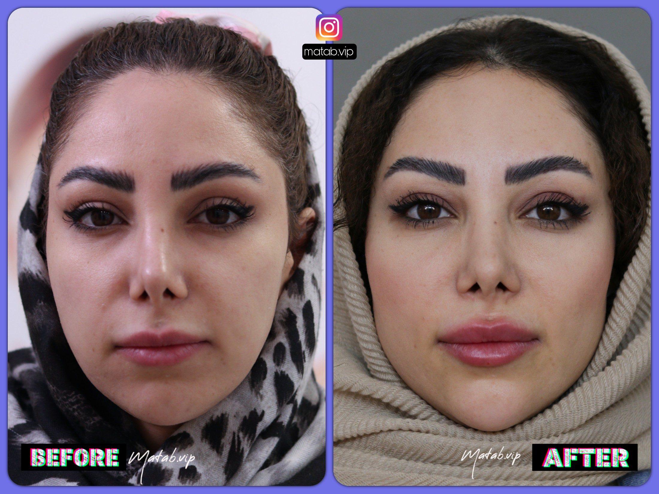 چگونه فرم VIP می‌تواند تجربه مشتری را بهبود بخشد